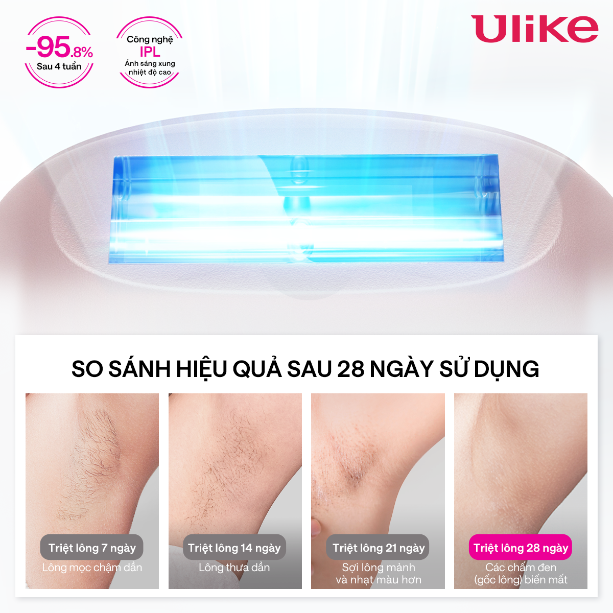 Máy triệt lông Ulike Swift 7 công nghệ làm mát Ice Cooling IPL Sapphire Hồng - LK