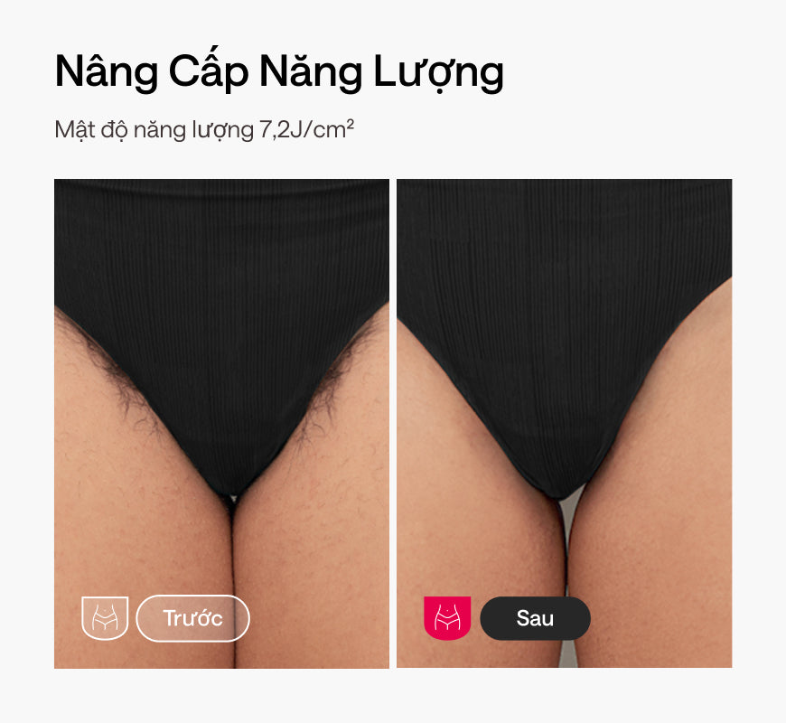 Ulike Swift 7 Máy triệt lông lạnh IPL