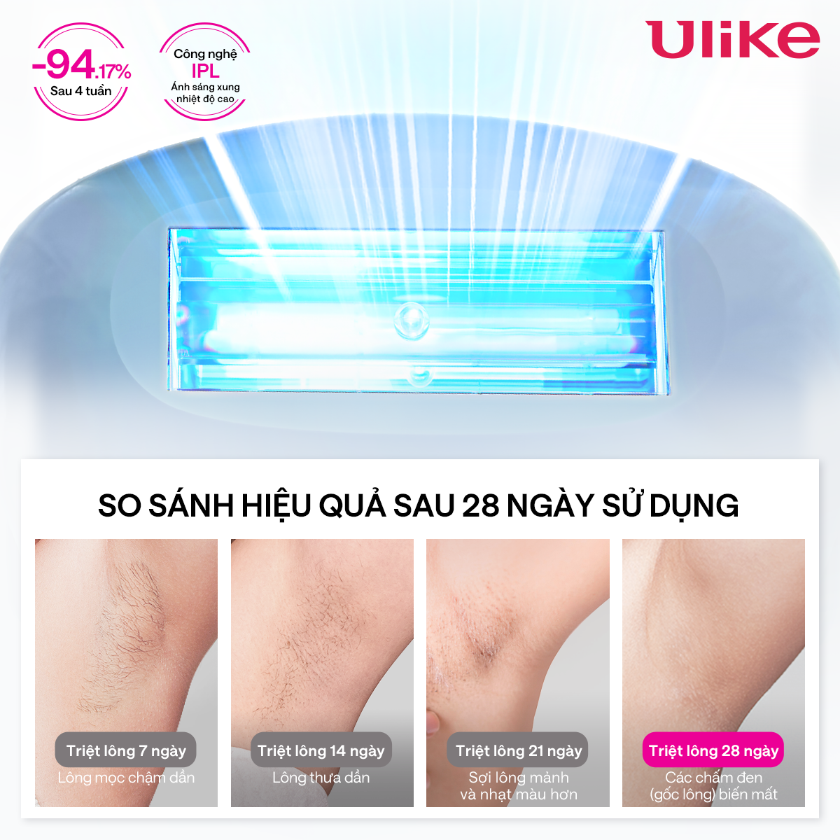 Máy triệt lông Ulike ME công nghệ làm mát Ice Cooling IPL Sapphire Xanh thiên thanh